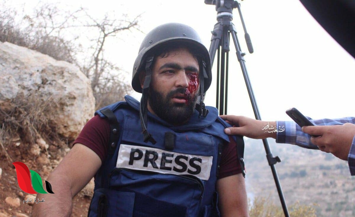 النقابة تؤكد فقدان 3 صحفيين لأعينهم برصاص الاحتلال في 2019