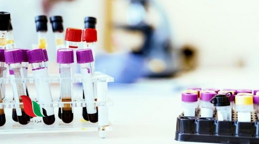 الدهون الزائدة في الدم