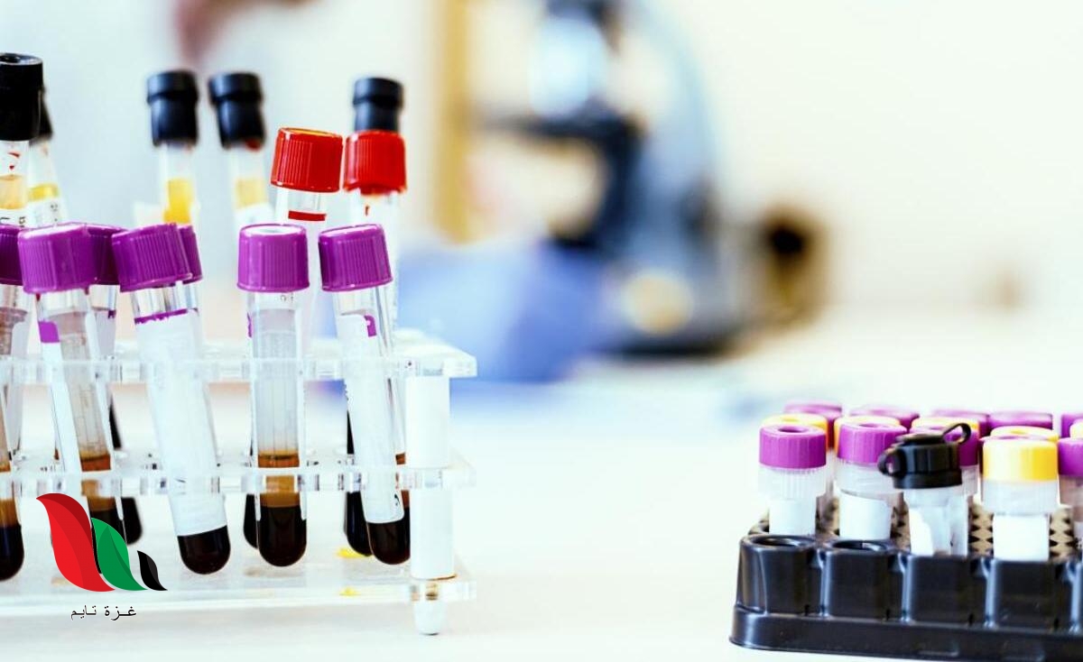 الدهون الزائدة في الدم