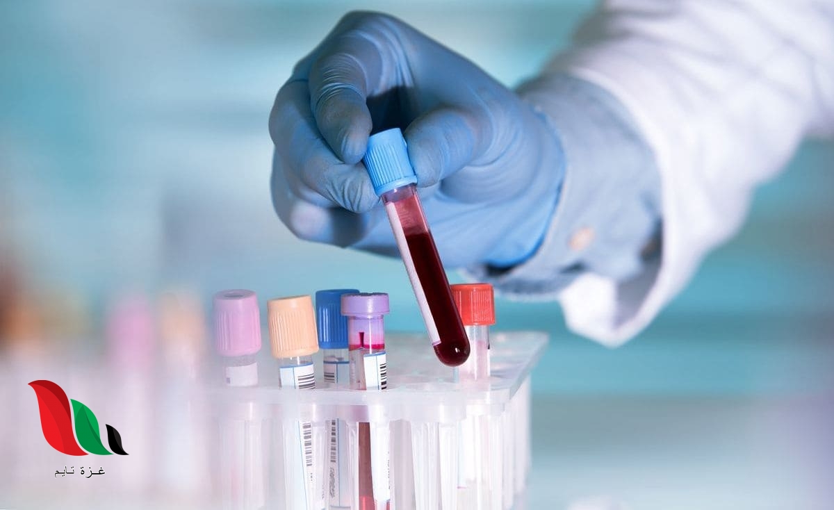 الاستعلام عن نتيجة فحص الزواج الكترونيا في السعودية