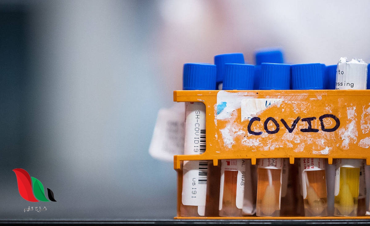 كيف اعرف نتيجة فحص كورونا في مراكز الرياض – حجز موعد