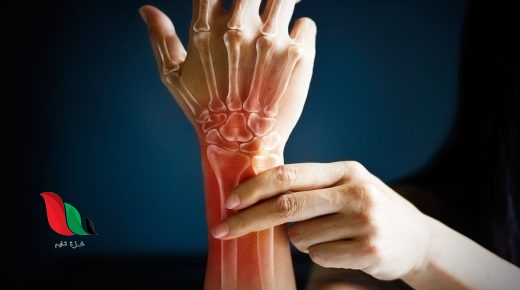 ما هي أفضل الأطعمة لصحة العظام؟