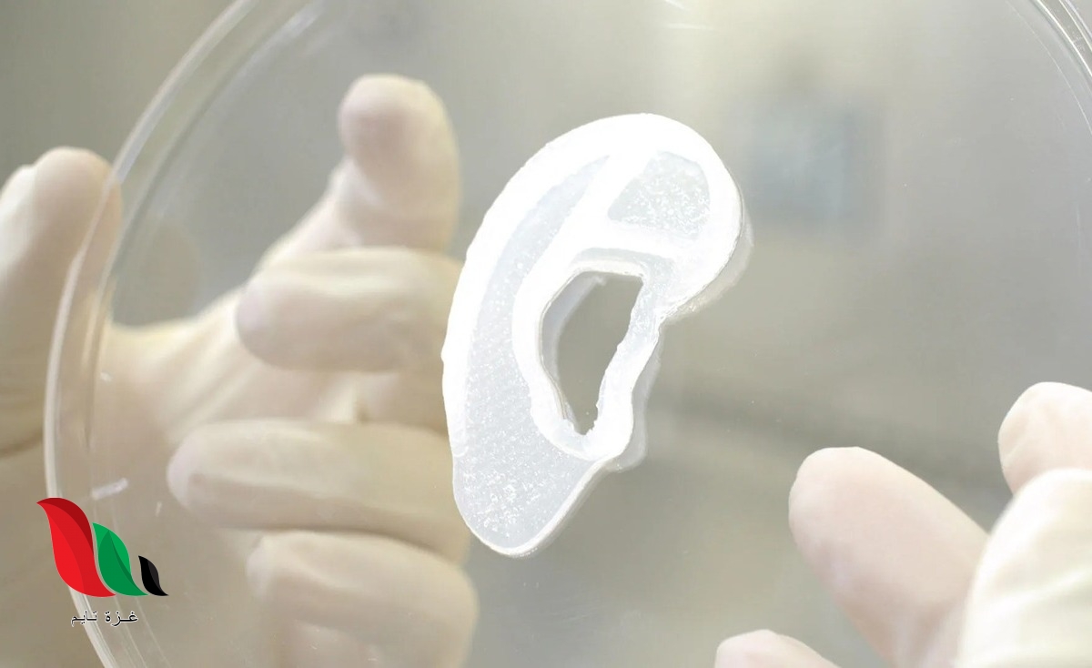 عملية مبتكرة.. زراعة أذن بشرية باستخدام غرسة ثلاثية الأبعاد