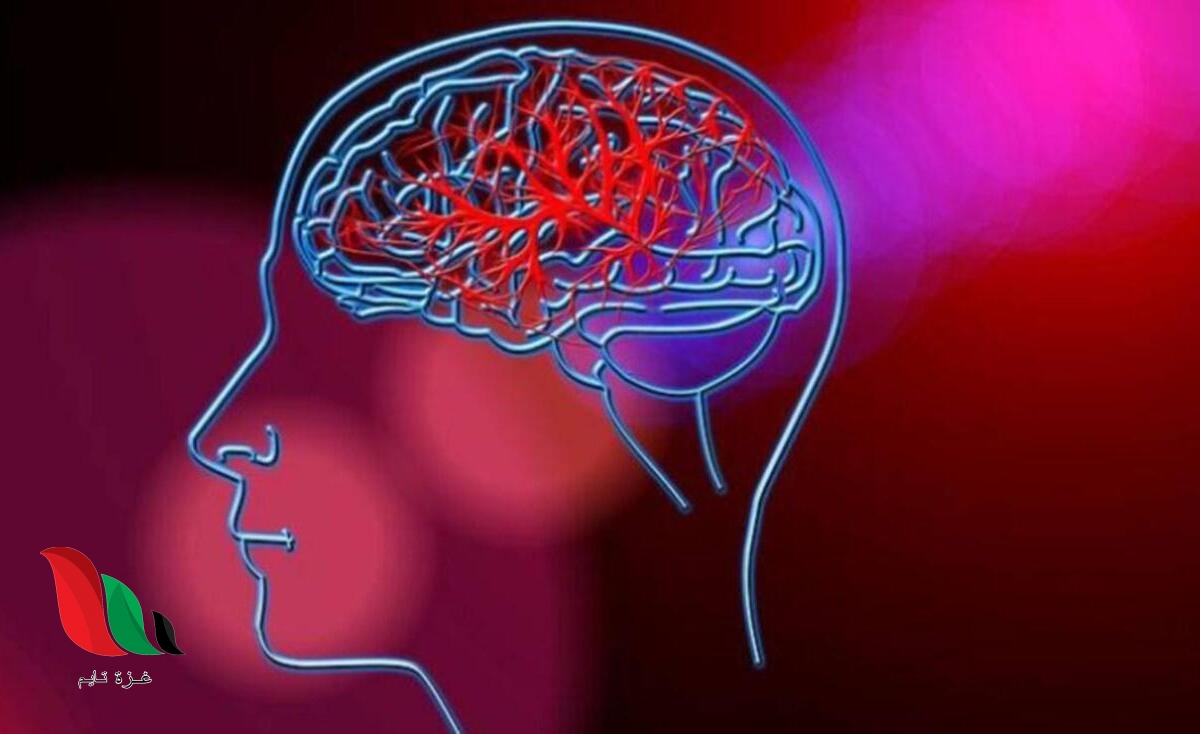 دراسة: النظام الغذائي أفضل من الجراحة لمنع السكتة الدماغية