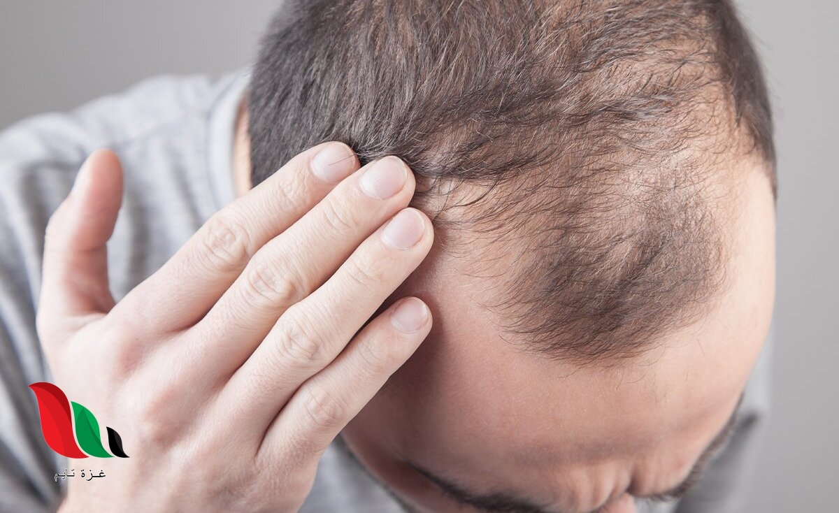 زراعة الشعر في تركيا 2022 2023 معلومات تفصيلية