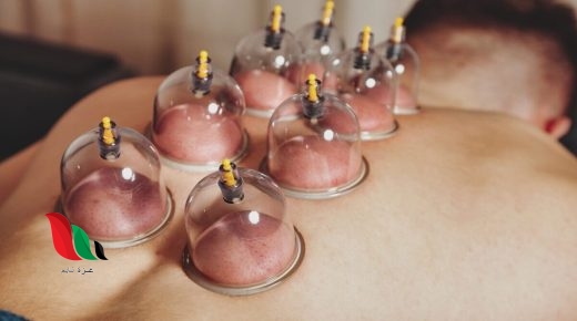 افضل ايام الحجامة في السنة للرجال عند ابن باز