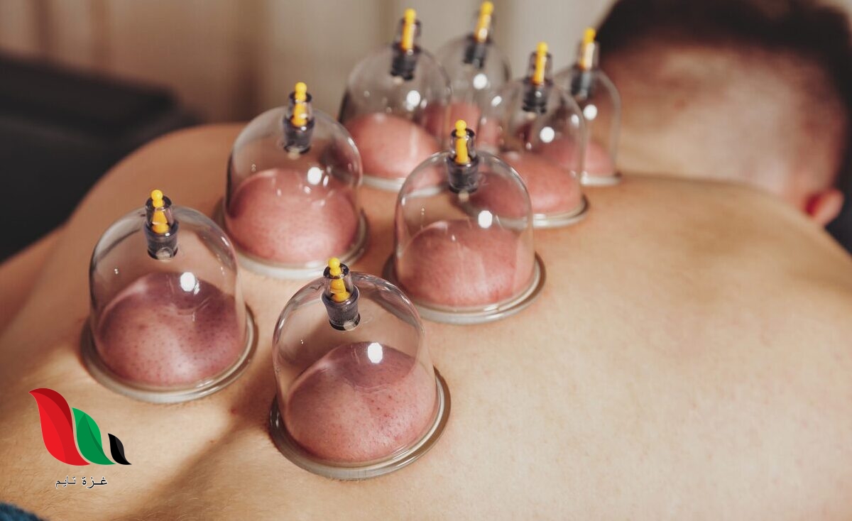 افضل ايام الحجامة في السنة للرجال عند ابن باز