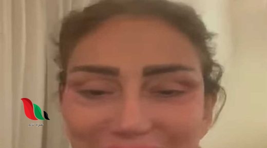 من هو طبيب التجميل الذي شوه وجه ريهام سعيد؟