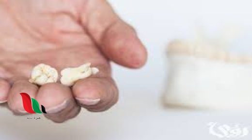 تفسير حلم سقوط الضرس في اليد بدون ألم