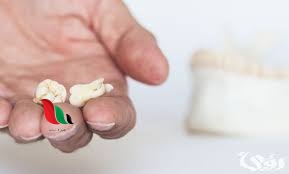 تفسير حلم سقوط الضرس في اليد بدون ألم