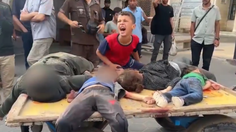 أي جريمة أبشع من قصف أطفال ينتظرون علاج الجوع؟