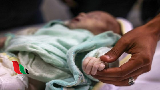 ارتفاع عدد ضحايا الجوع في غزة إلى 115 شهيدًا.. وأزمة غذاء تهدد حياة الأطفال
