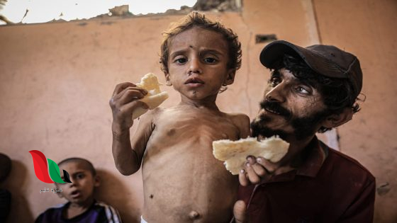 ارتفاع عدد ضحايا الجوع في غزة إلى 263 بينهم 112 طفلاً