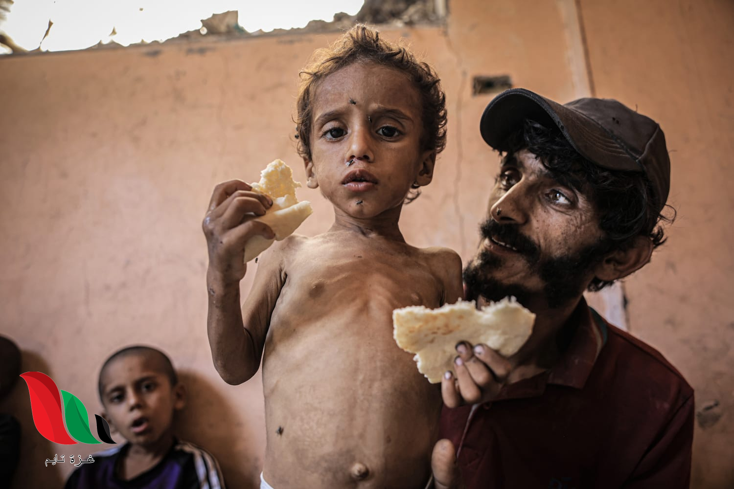 ارتفاع عدد ضحايا الجوع في غزة إلى 263 بينهم 112 طفلاً