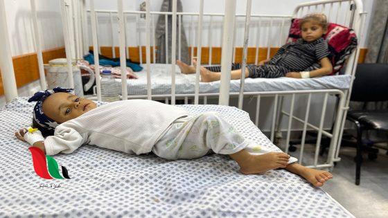 متلازمة غيلان باريه: تهديد صحي متزايد في غزة