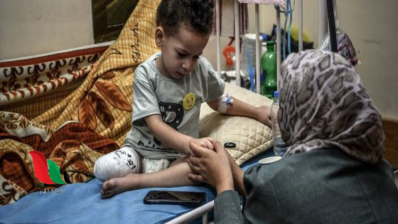 تقارير دولية معاناة أطفال غزة تتفاقم وعمليات جراحية تُجرى لهم بلا تخدير