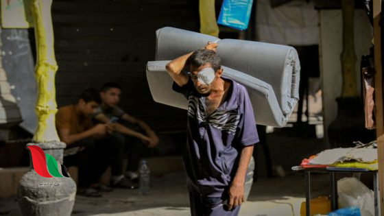 رابط تسجيل المواطنين المصابين بالعيون خلال الحرب على قطاع غزة